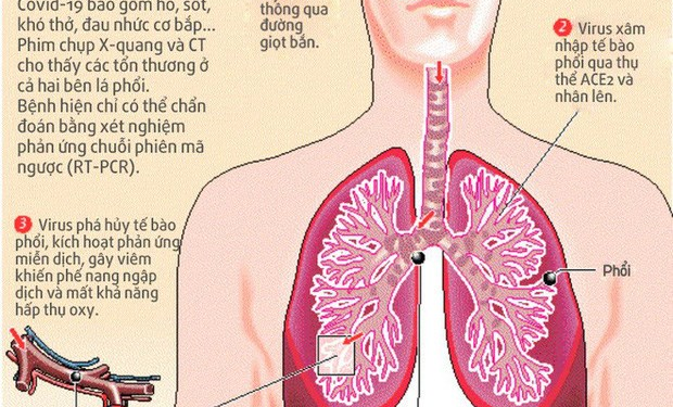 93060442 926036141180695 509428411735736320 N